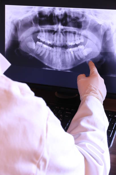 Best Emergency Tooth Extraction  in Aust, IN