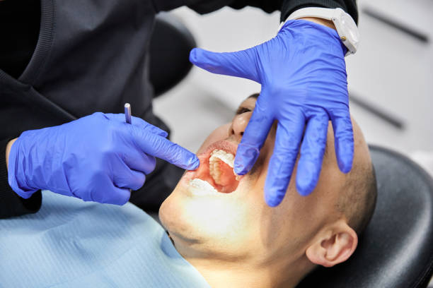 Tooth Infection Emergency Dentist in IN
